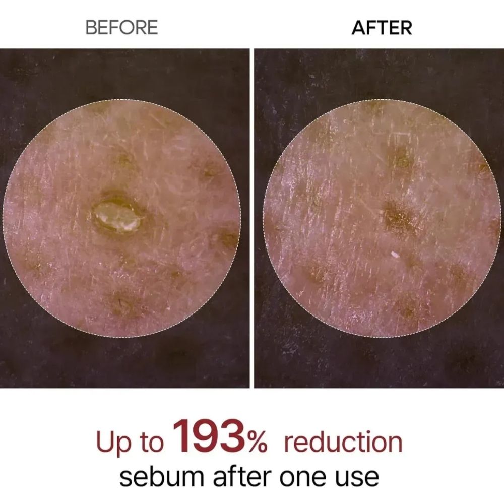 Kit Exfoliante Dr. Melaxin - Imagen 2