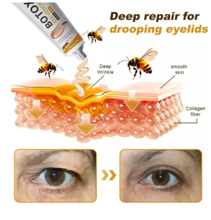 Lifting De Veneno De Abeja Botox - Imagen 3